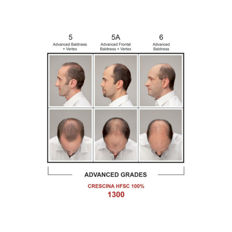 Crescina HFSC Man Complete Treatment – for thinning and hair subject to  fall – 
